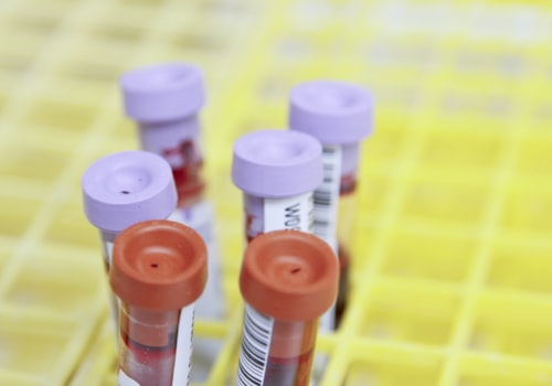 Preventive screenings worth scheduling